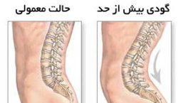 حرکات اصلاحی