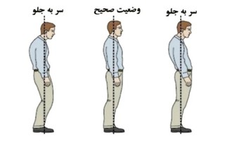 تمرینات اصلاحی جهت اصلاح ناهنجاری های اسکلتی/ بخش سوم