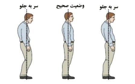 حرکات اصلاحی