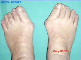 آنچه بهتراست درباره پاها بدانیم