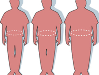 اپیدمیولوژی چاقی 