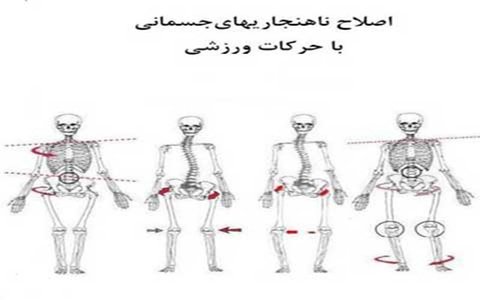 خدمات ویژه کلینیک حرکات اصلاحی  