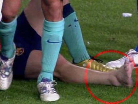 آسیب دیدگی مچ پا