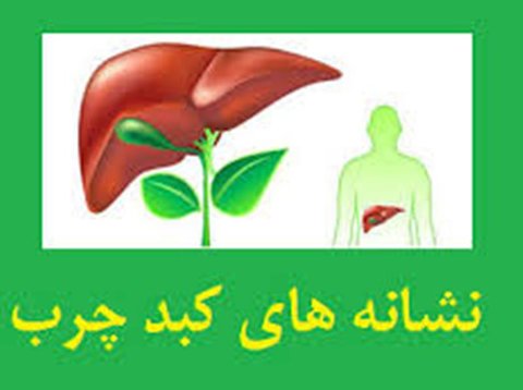 کبد چرب