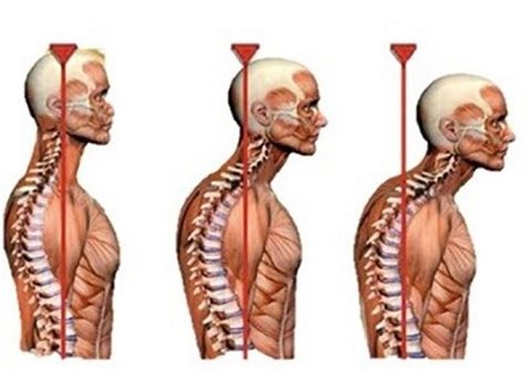 حرکات اصلاحی