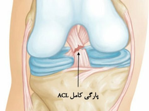 تمرینات توانبخشی پس از جراحی
