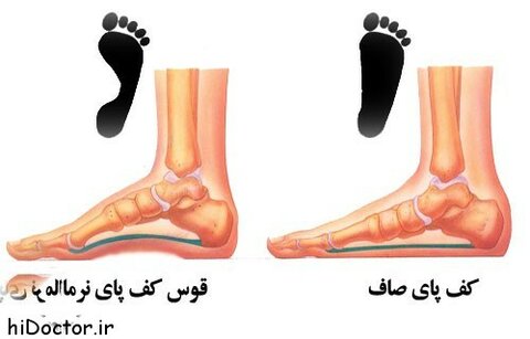 بررسی ضعفها و ناهنجاریهای اکتسابی دستگاه استخوانی، عضلانی و مفصل افراد جامعه