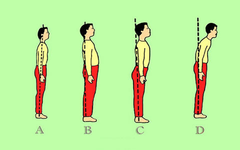 کارگاه آموزشی ارزیابی و شناسایی ناهنجاریهای اسکلتی - چهار محال وبختیاری