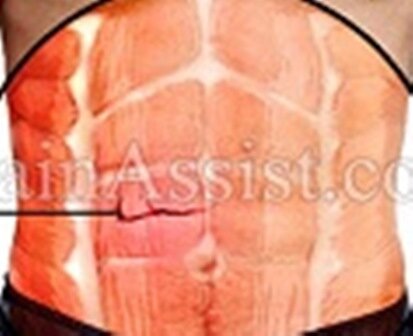 عضلات شکمی