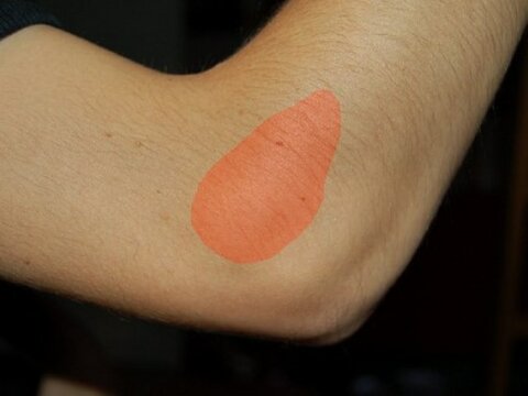 آرنج تنیس بازان