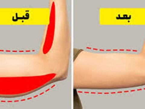 رابطه چاقی با بازوها