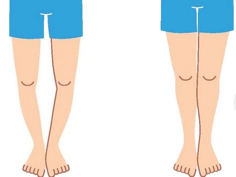 زانوی پرانتزی