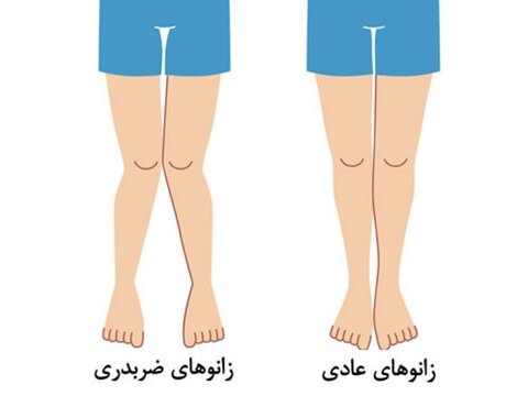 زانوی ضربدری