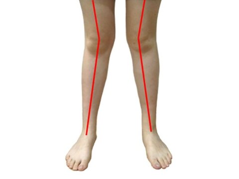 زانوی ضربدری