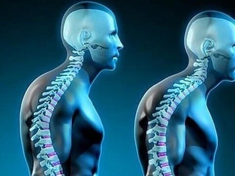 ناهنجاری پشت گرد