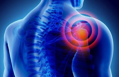 آسیب های شانه