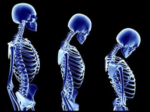 ناهنجاری سر به جلو