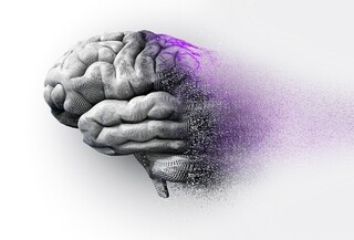 نداشتن فعالیت های بدنی از دلایل اصلی آلزایمر