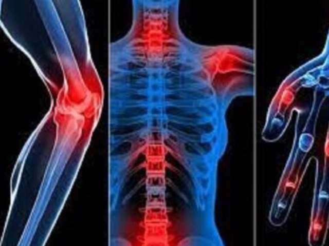 آرتروزچیست؟(بخش دوم)