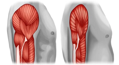 sarcopenia.jpg