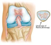 آیا صدا دادن مفاصل نگران کننده است؟