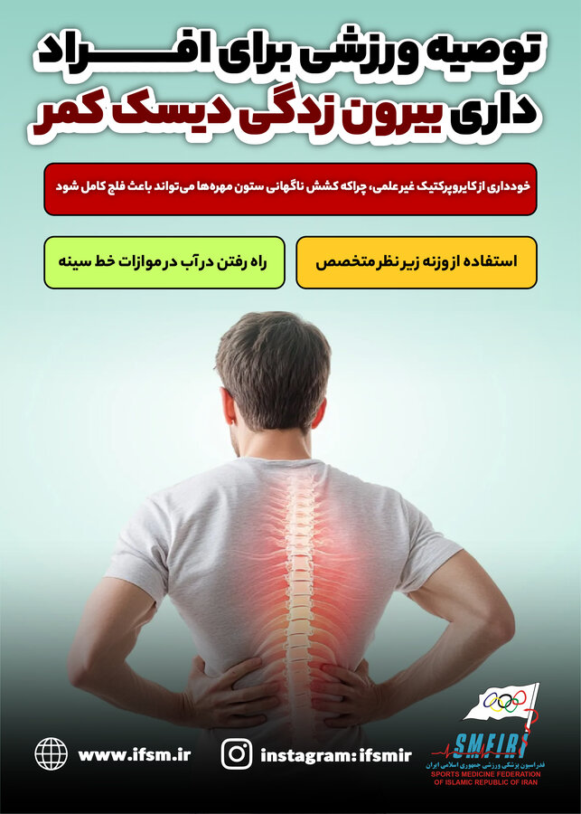 چند توصیه ورزشی درباره بیرون زدگی دیسک کمر