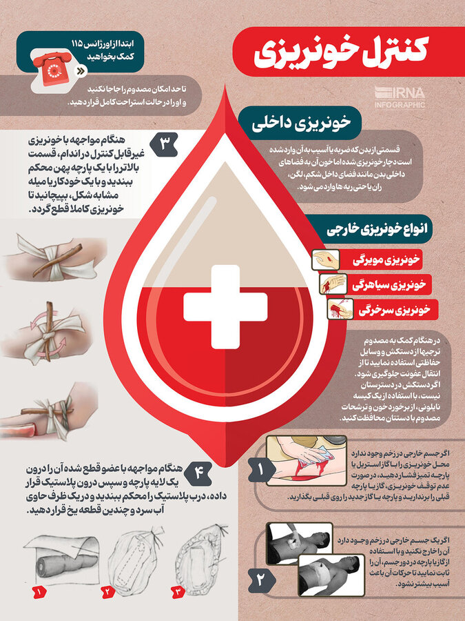 کنترل خونریزی/اینفوگرافیک