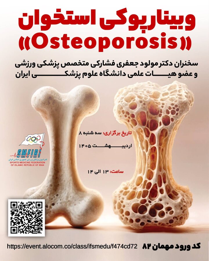 وبینار پوکش استخوان